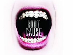 root-cause