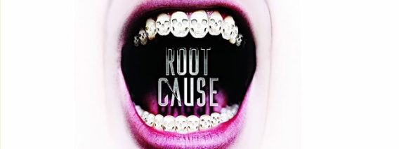 root-cause
