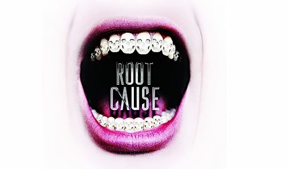 root-cause